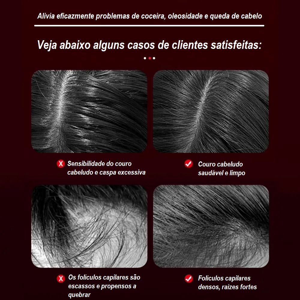 Escova de Cabelo Massageador -Hair Strong beleza 001 Loja da Dryka