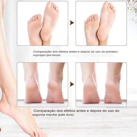 Aparelho Esfoliante de Pés - Beauty feet