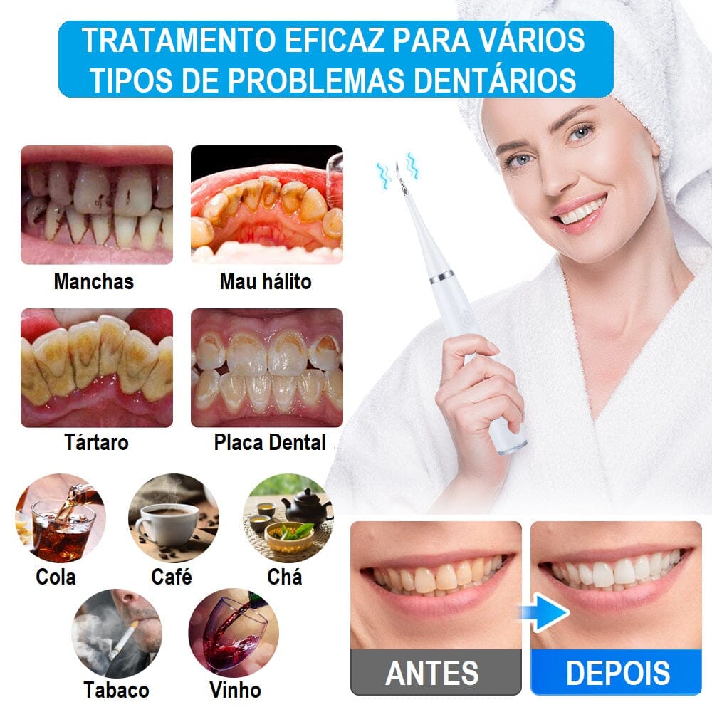 Removedor de Tártaro e Placas Ultrasônico - Easy Clear bem estar 038 Loja da Dryka