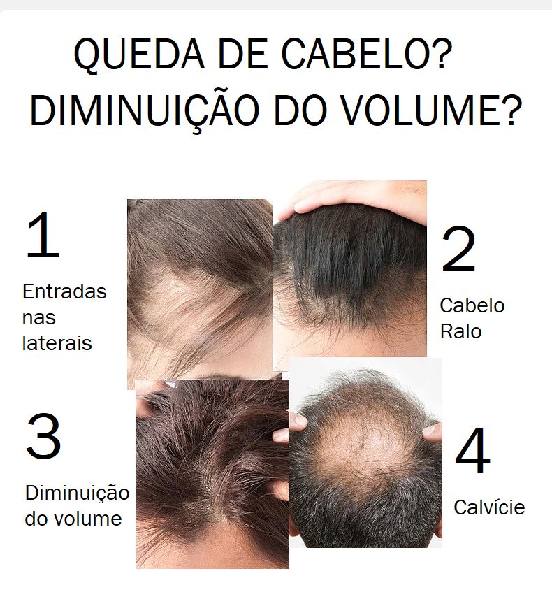 Aparelho de Massagem Capilar + Óleo Essencial beleza 037 Loja da Dryka 