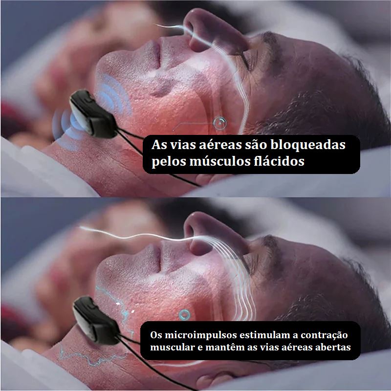 Dispositivo Anti Ronco Inteligente bem estar 008 lojadadryka 