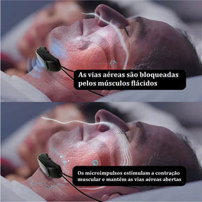 Dispositivo Anti Ronco Inteligente bem estar 008 lojadadryka 