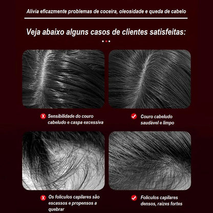 Escova de Cabelo Massageador -Hair Strong beleza 001 Loja da Dryka 