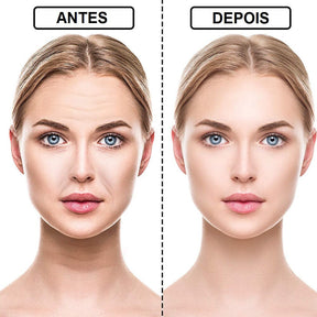 Adesivo de Silicone Antirrugas e Linhas de Expressão - CLEAR WOMEN Beleza 003 lojadadryka 